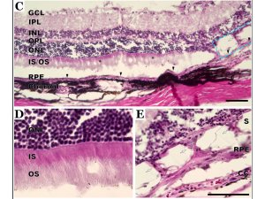 Local tolerability of DTVRF-hiPSC-ARG