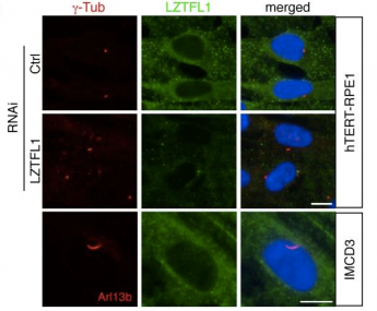 LZTFL1 localizes to the cytoplasm but not cilia or basal body. Localization of LZTFL1 (green) was probed with anti-LZTFL1 antibody in hTERT-RPE1 (top and middle rows) and IMCD3 (bottom row) cells after 30 hrs of serum withdrawal. Antibodies against γ-tubulin and Arl13b (red) were used to mark the basal body and cilia, respectively. Nuclei were stained with 4',6-diamidino-2-phenylindole (DAPI, blue). LZTFL1 localizes to the cytoplasm but not cilia or basal body. Localization of LZTFL1 (green) was probed with anti-LZTFL1 antibody in hTERT-RPE1 (top and middle rows) and IMCD3 (bottom row) cells after 30 hrs of serum withdrawal. Antibodies against γ-tubulin and Arl13b (red) were used to mark the basal body and cilia, respectively. Nuclei were stained with 4',6-diamidino-2-phenylindole (DAPI, blue).