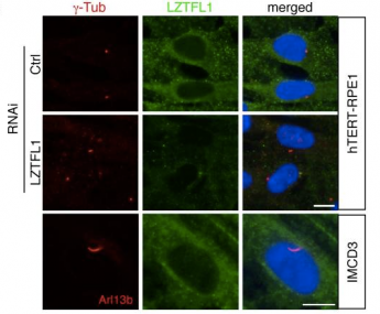 LZTFL1 localizes to the cytoplasm but not cilia or basal body. Localization of LZTFL1 (green) was probed with anti-LZTFL1 antibody in hTERT-RPE1 (top and middle rows) and IMCD3 (bottom row) cells after 30 hrs of serum withdrawal. Antibodies against γ-tubulin and Arl13b (red) were used to mark the basal body and cilia, respectively. Nuclei were stained with 4',6-diamidino-2-phenylindole (DAPI, blue). 