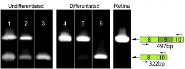 Insertion of an Alu repeat into MAK exon 9 results in improper splicing and loss of the mature MAK protein. RT-PCR analysis of MAK exon 9 expression using a primer pair spanning exons 8–10 in undifferentiated (lanes 1–3) and differentiated (lanes 4–6) iPSCs and adult human retina (lane 7). Undifferentiated iPSCs from the normal control (lane 1) and RP control (lane 2) individuals exhibit two species, one with and one without exon 9. In contrast, undifferentiated iPSCs from the patient with the Alu insertion