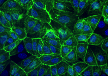 Endothelial cells. Green indicates actin fibers and blue indicates cell nuclei. These cells respond to AREDS vitamins by becoming less inflammatory. Endothelial cells.