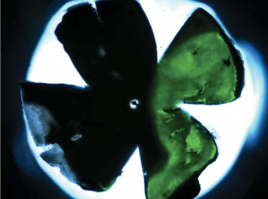 Flat mount of mouse retina showing delivery of transgene (green fluorescence). Flat mount of mouse retina showing delivery of transgene (green fluorescence).