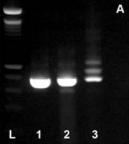 RT-PCR analysis of ABCA4 in RNA extracted from human control retina (lane 1), human keratinocytes isolated from an unaffected individual (lane 2), and human keratinocytes isolated from a patient with ABCA4 associated retinal degeneration (lane 3). An intronic splice site mutations in IVS 36 of the ABCA4 gene result in the introduction of an alternate exon (36.1).