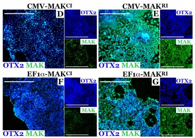 Evaluation of MAK isoforms in patient-derived photoreceptor precursors.